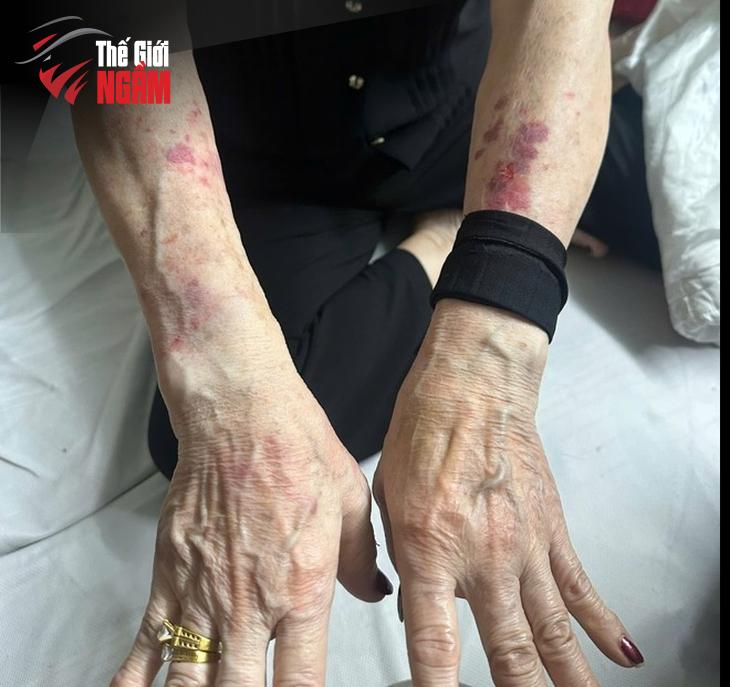 Động cơ và hệ lụy từ tình trạng 
