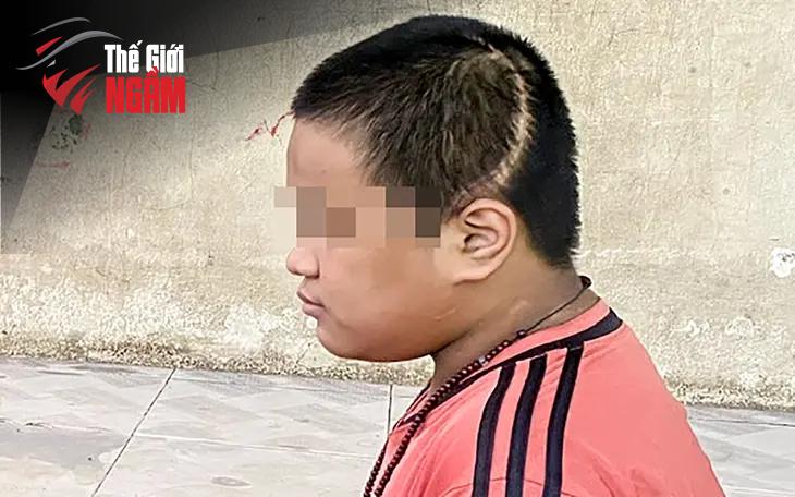 Các bước đi cần thiết để tránh thảm kịch