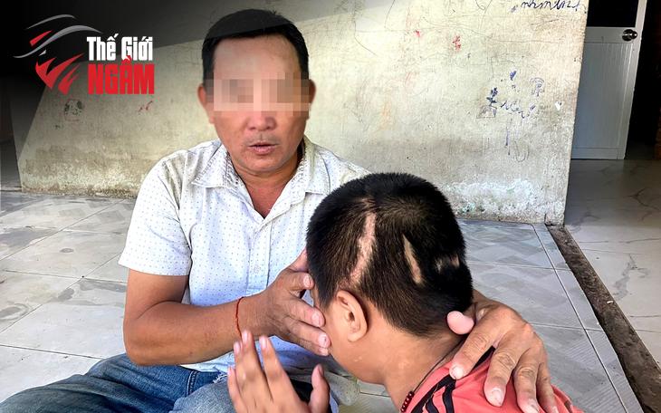 Sự Thờ Ơ Đến Từ Gia Đình Người Gây Tai Nạn